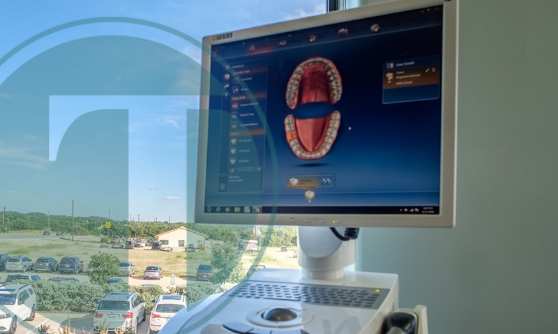 What to Expect During Your Same Day CEREC Crowns Visit