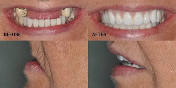 tomasik family dental smile restoration